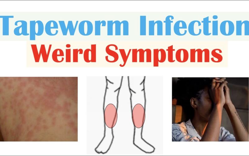 Tapeworm: La historia del supergrupo frustrado de Trent Reznor